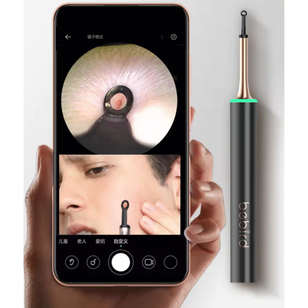 Xiaomi Bebird T15  Limpia Oídos y Extractor de Acné 2 en 1 con Cámara HD™