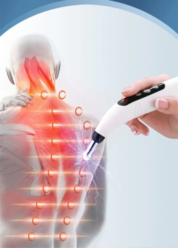 Pluma de Acupuntura Portátil Alivio Natural e Inmediato del Dolor Muscular Estimula, Relaja Músculos, Reduce Estrés™