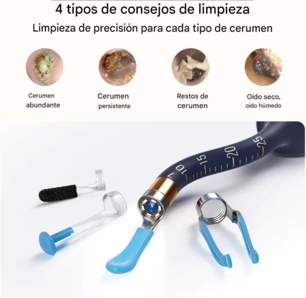 Kit de Accesorios de Repuesto para Otoscopios Bebird Universal™