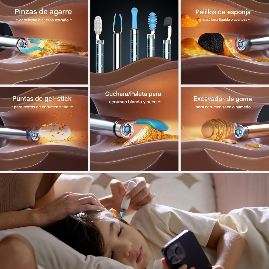 Otoscopio Inteligente Bebird H30S Profesional™
