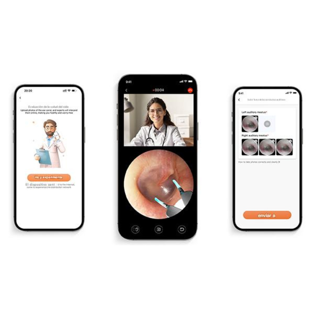 Otoscopio Inteligente Bebird H30S Profesional™