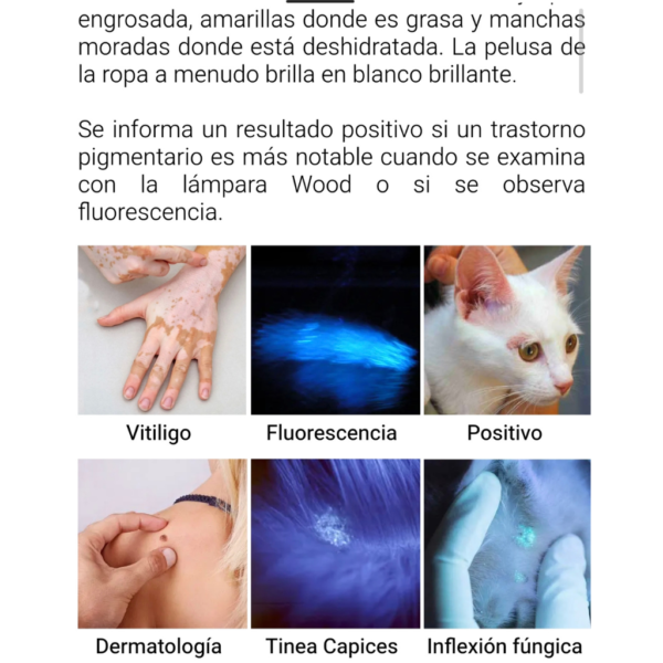 Lámpara Médica de Wood UV Profesional  GlowUp IBOOLO DE-315™