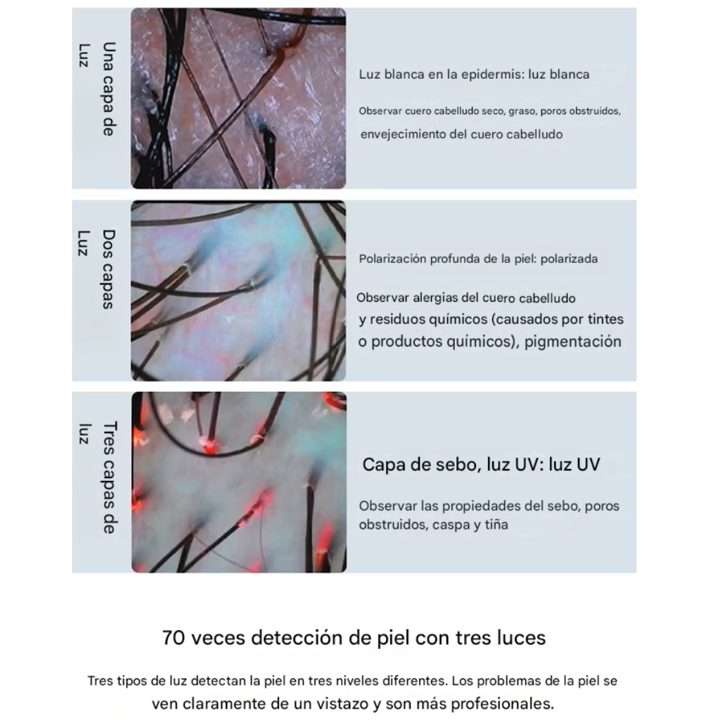 13 Tricoscopio Digital Inteligente Profesional para Análisis Capilar y Cuero Cabelludo MES-152™