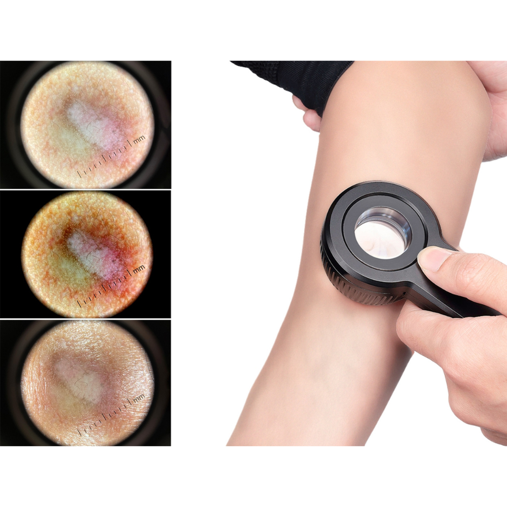 15 Dermatoscopio Profesional Digital Polarizado Glowup DE-3100™