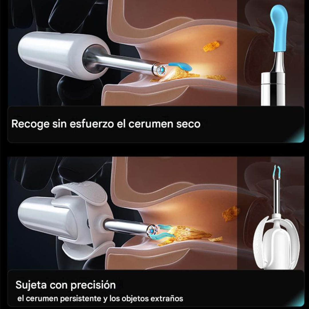 Otoscopio Inteligente Bebird H30S Profesional™