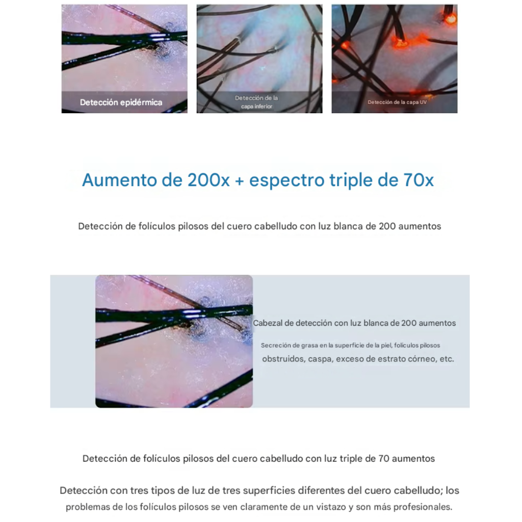 23 Tricoscopio Digital Inteligente Profesional para Análisis Capilar y Cuero Cabelludo MES-152™