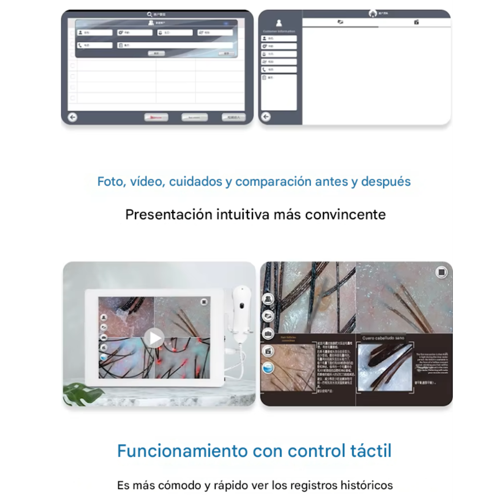 24 Tricoscopio Digital Inteligente Profesional para Análisis Capilar y Cuero Cabelludo MES-152™