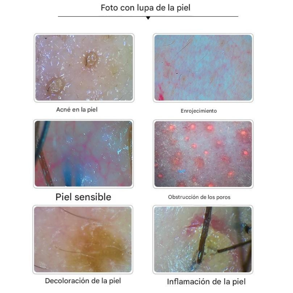 Analizador Profesional de Cabello y Cuero Cabelludo 4 Espectros BD-152A™