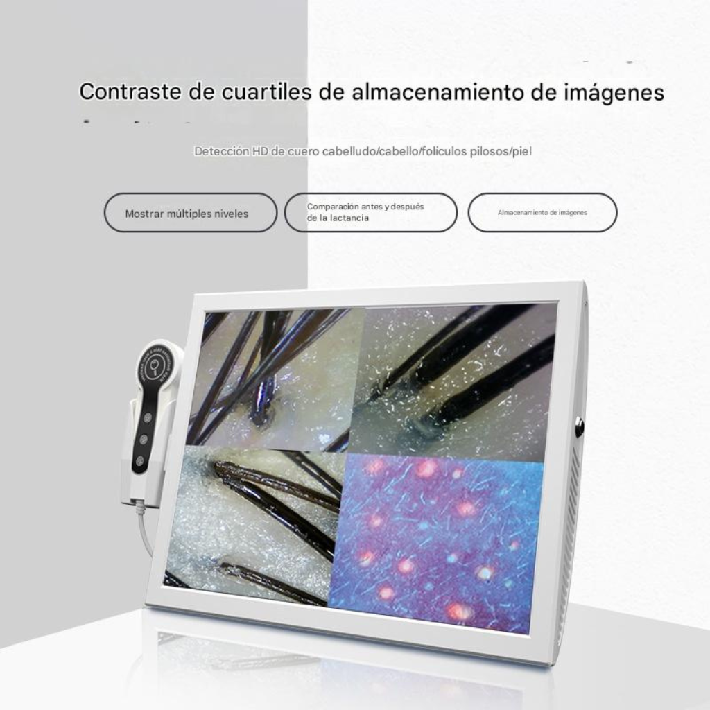 Analizador Profesional de Cabello y Cuero Cabelludo 4 Espectros BD-152A™