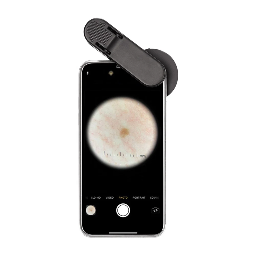 Dermatoscopio Digital Profesional Iboolo DE-300™