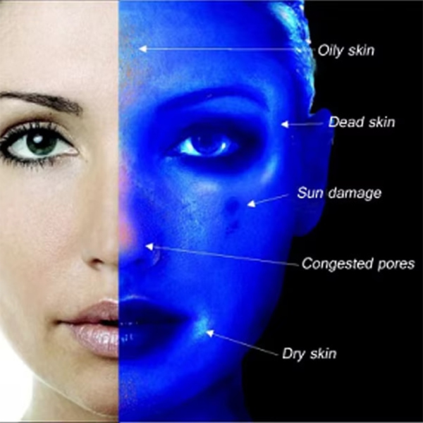 Lámpara Médica de Wood UV Profesional  GlowUp IBOOLO DE-315™