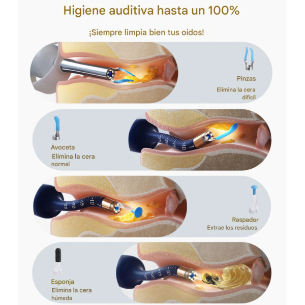 Otoscopio Inteligente Bebird EarSight Plus®