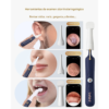 Otoscopio Inteligente Bebird EarSight Plus®