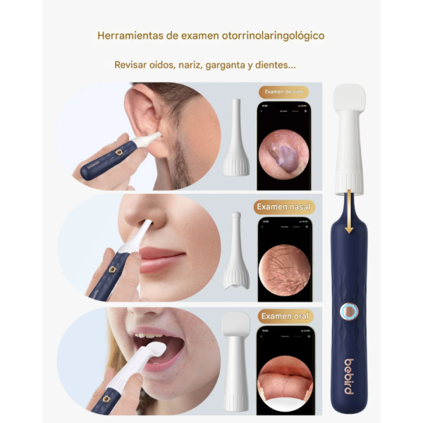 Otoscopio Inteligente Bebird EarSight Plus®