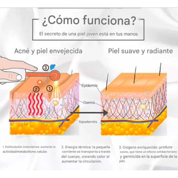 DISPOSITIVO DE ALTA FRECUENCIA PORTÁTIL PROFESIONAL(TM)