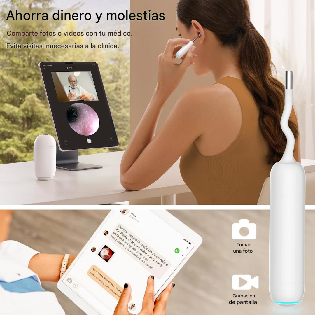Otoscopio Inteligente Bebird H30S Profesional™