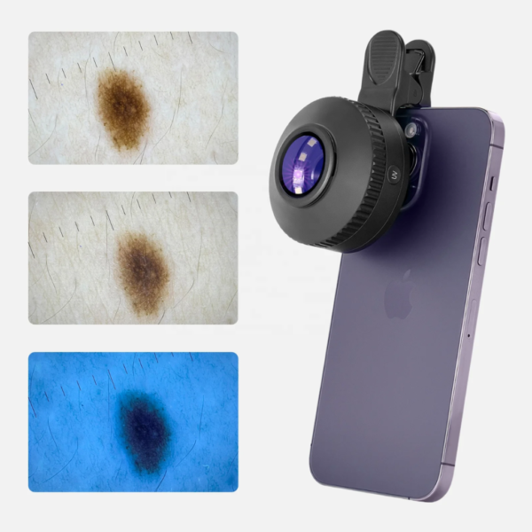 6 Dermatoscopia Profesional Digital Polarizado UV GlowUp DE-500™