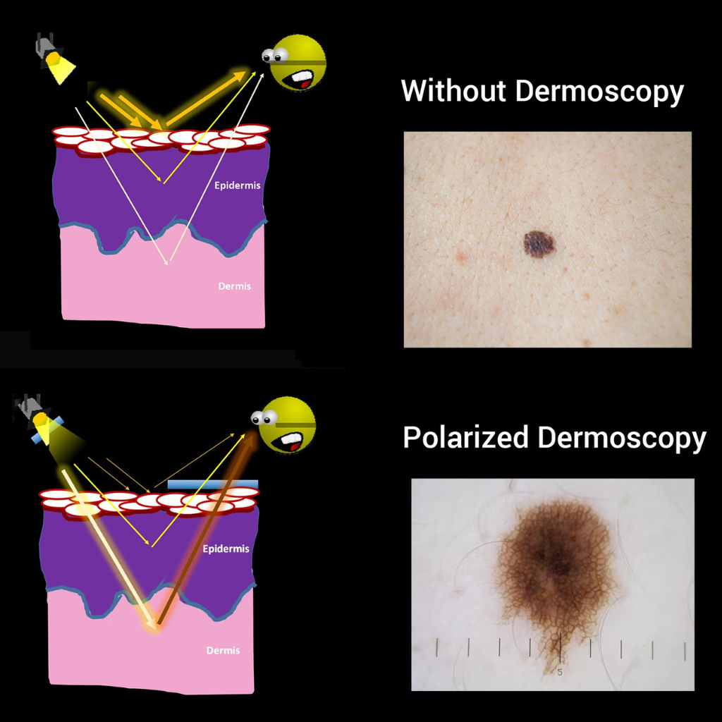 Dermatoscopio Profesional Digital GlowUp DE-400™