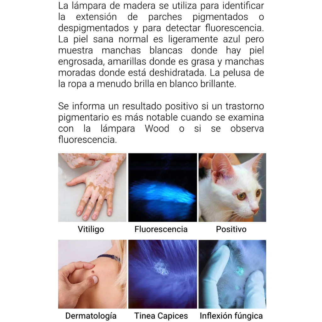 Lámpara de Wood UV Glow Up DE-215™