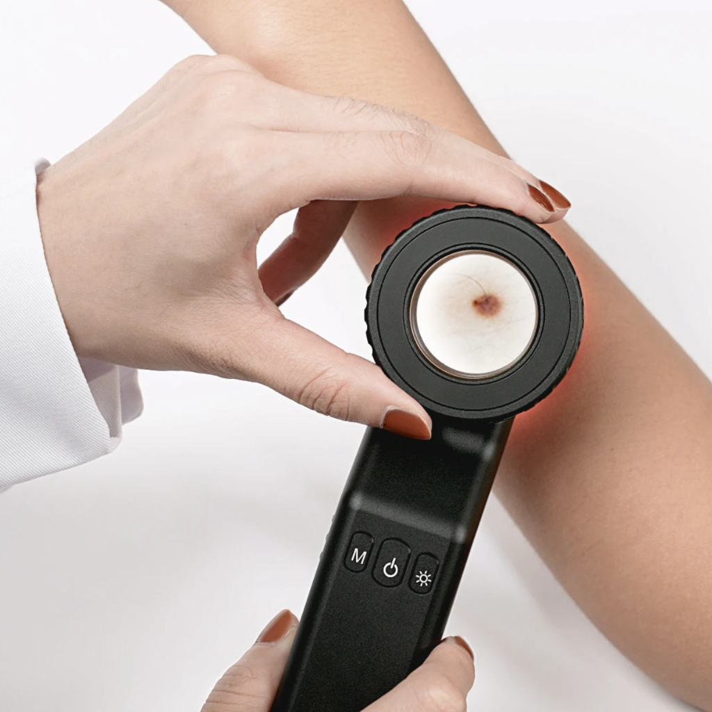 Dermatoscopio Profesional Digital UV DE-4100 PRO™