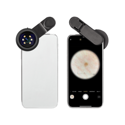 Dermatoscopio Digital Profesional Iboolo DE-300™