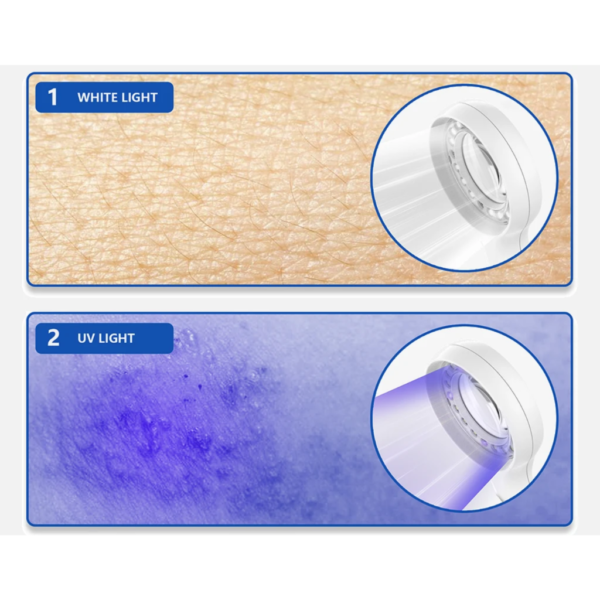Lámpara de Wood UV Glow Up DE-215™