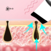 Paleta Ultrasónica Facial Profesional Profunda sin Invación™