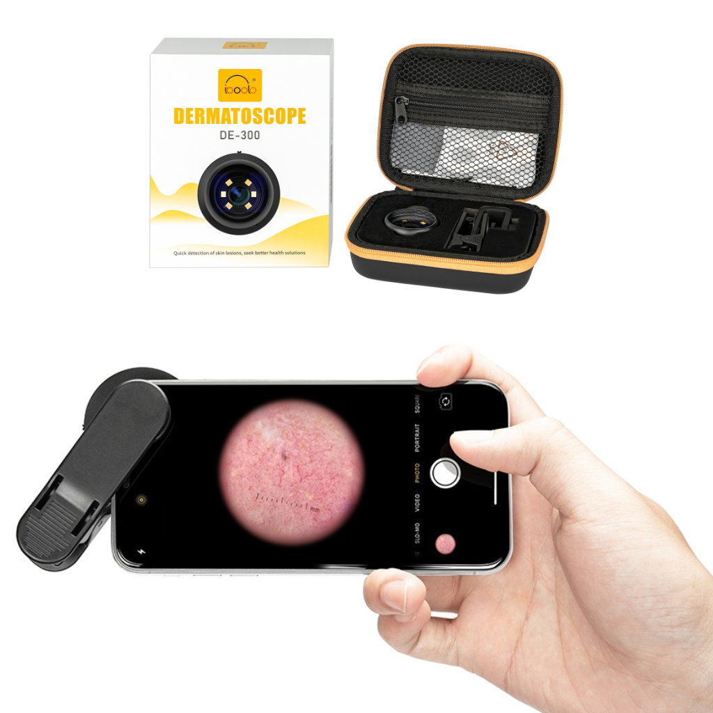 Dermatoscopio Digital Profesional Iboolo DE-300™