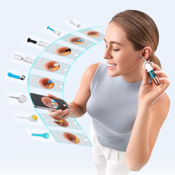 Kit de Accesorios de Repuesto para Otoscopios Bebird Universal™