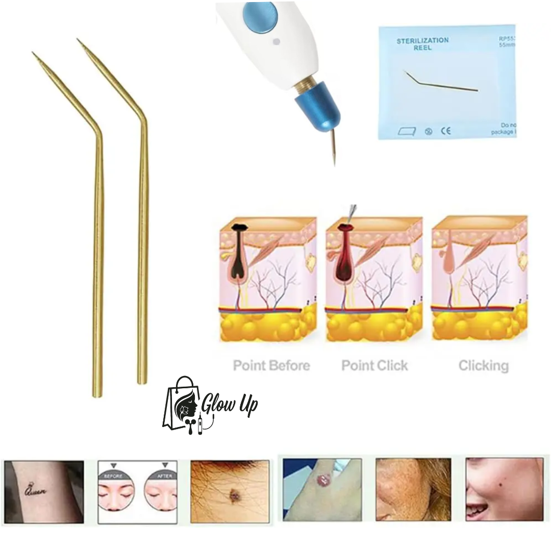 21 x24 Agujas Esterilizadas para Plasma Fibroblast Profesionales™